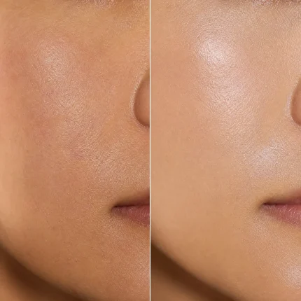 Applying Sisterly Fruits Acid Peeling Serum for smoother skin in Kenya